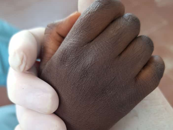 Dignidad y Esperanza: Otros Programas de Seguimiento Crónico